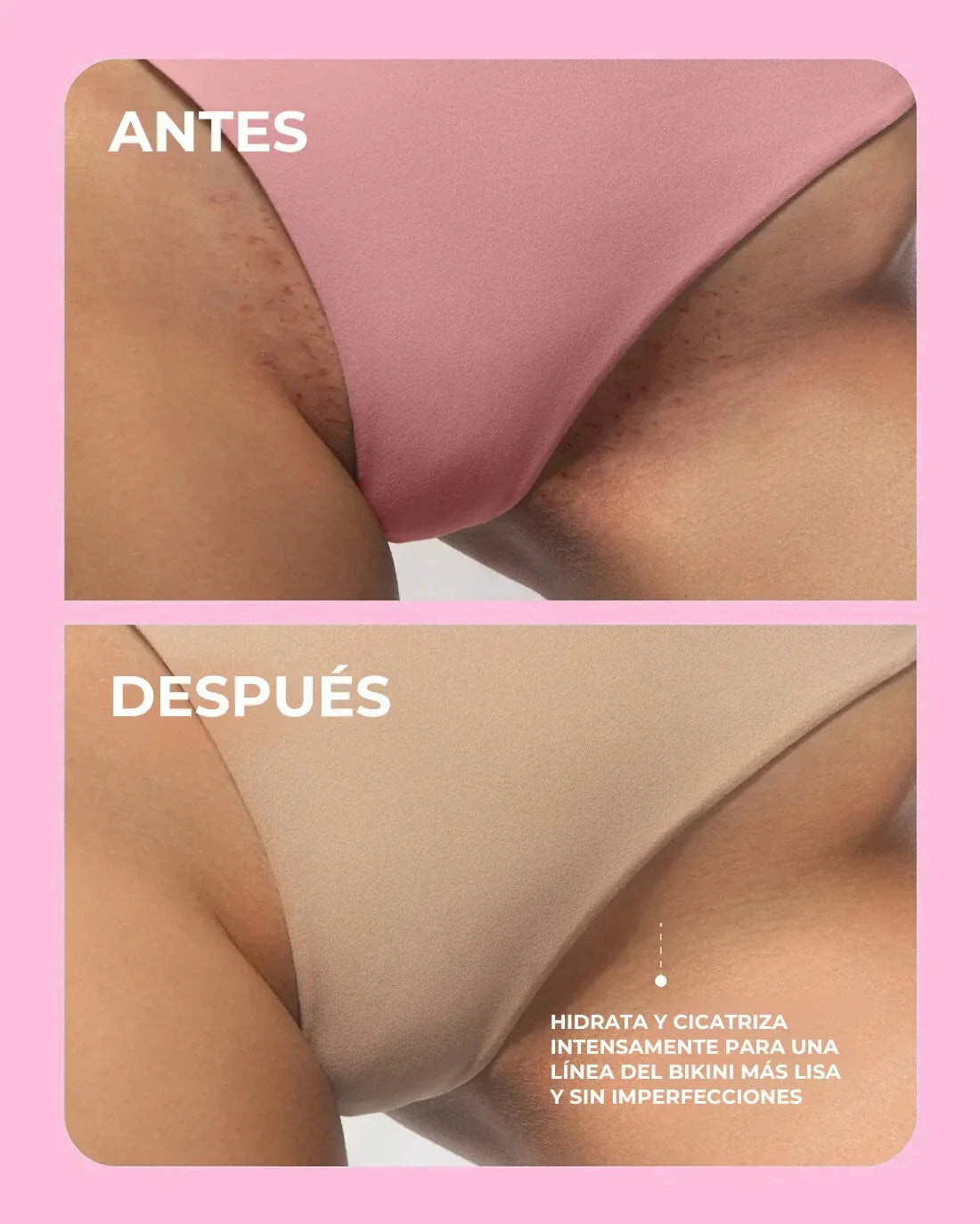Antes y después