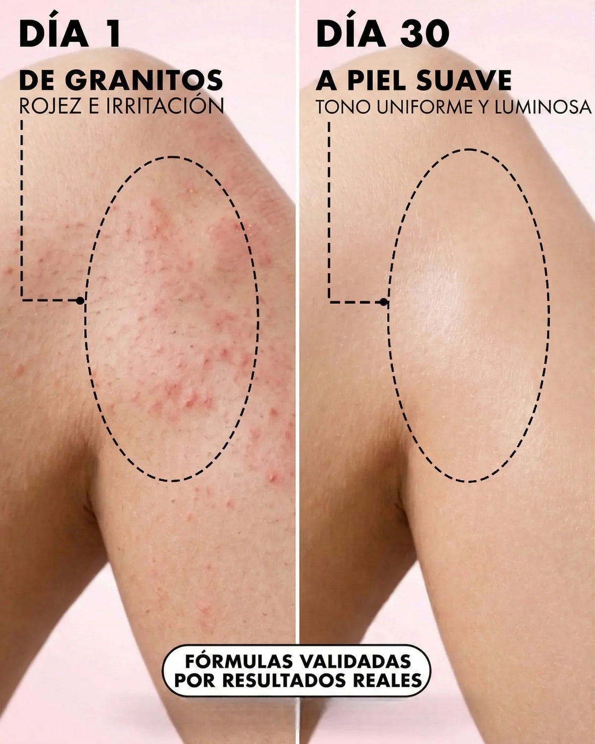 2x1 Aceite Truly Soft Serve Fresa | Hidrata, Elimina manchas y Vellos Encarnados💗