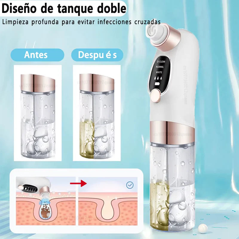 Micro Bubble Pro: Elimina Puntos Negros y Espinillas en minutos ✨