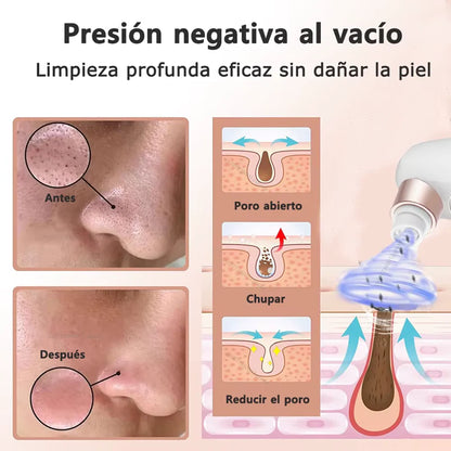 Micro Bubble Pro: Elimina Puntos Negros y Espinillas en minutos ✨