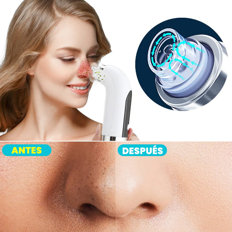 Micro Bubble Pro: Elimina Puntos Negros y Espinillas en minutos ✨