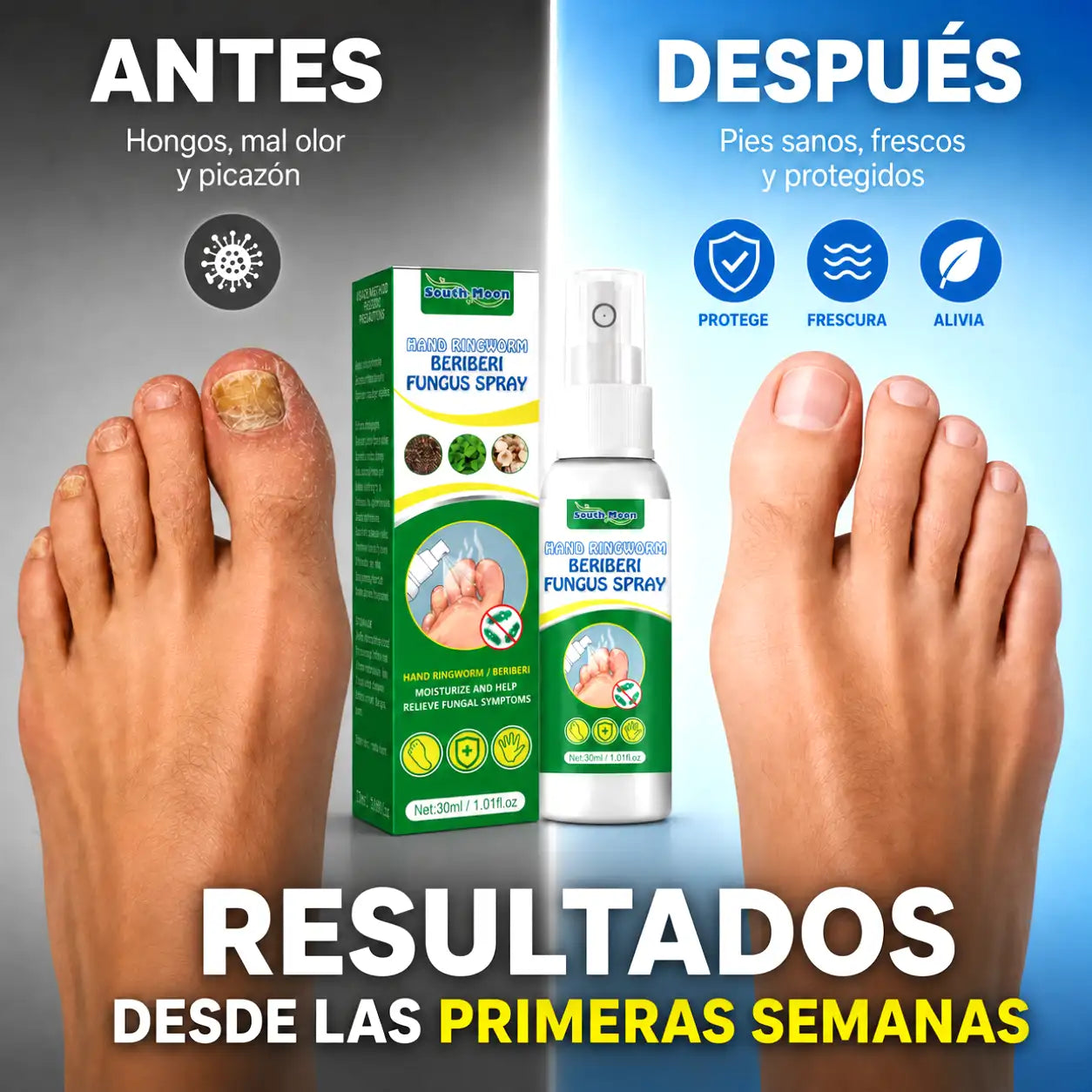 Spray Antihongos Natural 30ML | Alivia hongos, mal olor y picazón desde casa